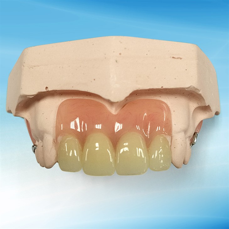 Bażi tad-dentatura akrilika parzjali tad-dwana (imwaqqfa bis-snien lesti) - laboratorju dentali
