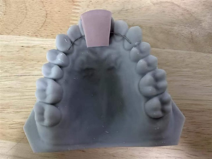 3D Stampat Fiss Retainer China Dental Lab