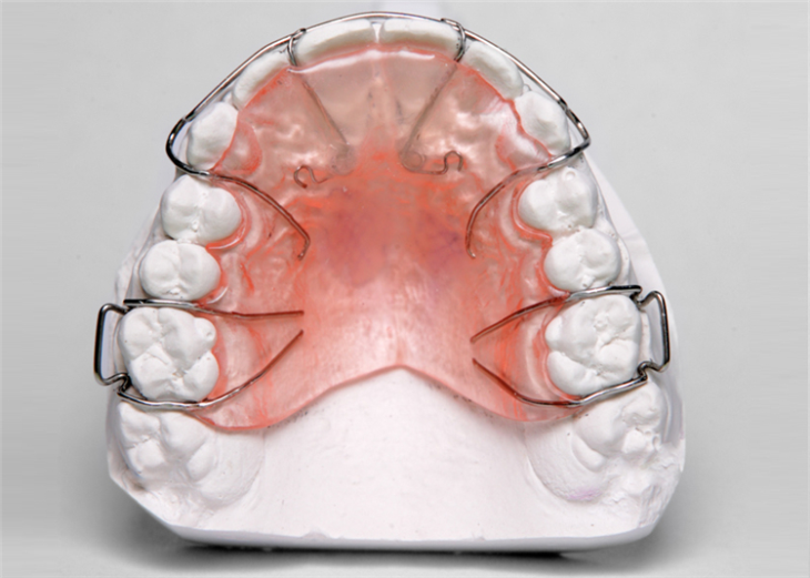 Retainer Dentali Professjonali
